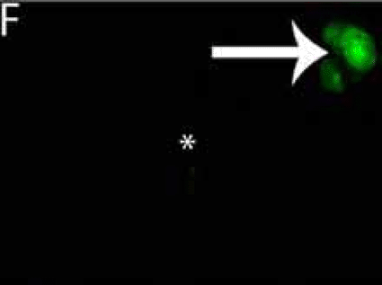 Image: Infrared fluorescent labels, targeted to cancerous tumor cells, provide a luminescent guide for surgeons trying to remove the lethal tissue (photo courtesy Proceedings of the National Academy of Sciences). Image: Infrared fluorescent labels, targeted to cancerous tumor cells, provide a luminescent guide for surgeons trying to remove the lethal tissue (photo courtesy Proceedings of the National Academy of Sciences).